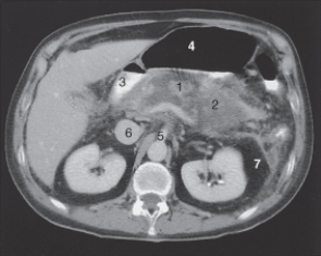 <strong>The duodenum is labeled: </strong> A)1. B)2. C)3. D)4.