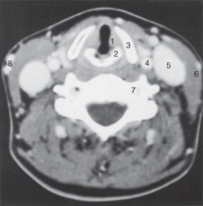 <strong>The structure labeled as 5 is the:  </strong> A) internal carotid artery. B) internal jugular vein. C) sternocleidomastoid muscle. D) vertebral artery. <div style=padding-top: 35px> 