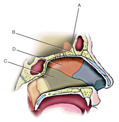 Match each labeled landmark or bone in the following figure to the correct descriptor. Terms may be used more than once or not at all.   -Cribriform plate
