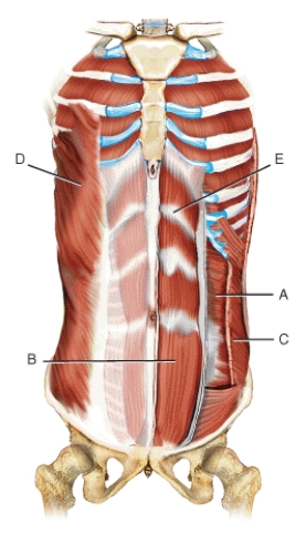 Identify the muscles indicated on the following figure using the letters provided. Letters may be used more than once or not at all. -Internal oblique abdominis