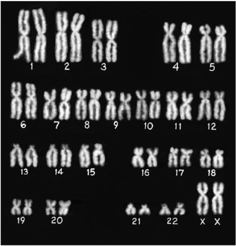 <strong>What is the gender of the person indicated in the photograph? </strong> A)Male B)Female C)Cannot be determined