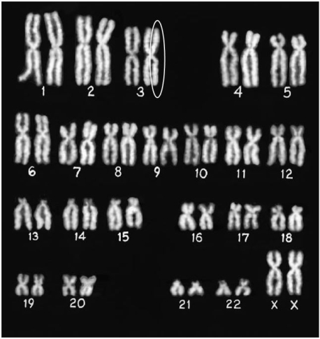 <strong>In the picture below, what is encircled? </strong> A)A sister chromatid B)A single chromosome C)Two sister chromatids D)A pair of homologous chromosomes