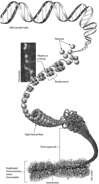 <strong>Examine the figure below. Nucleosomes are made of ________. </strong> A)RNA and protein B)DNA and no protein C)DNA and histone proteins