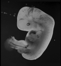 <strong>Examine the embryo in the figure. The hands and feet of this embryo appear paddle-like, with no distinct toes or fingers. What process is needed to define each of the toes and fingers? </strong> A)programmed cell death B)neurulation C)gastrulation D)induction