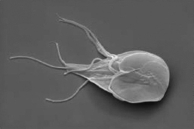 In the associated image, the aquatic organism moves using flagella. It is parasitic and can colonize and reproduce in the human intestine. What type of organism could this be?
