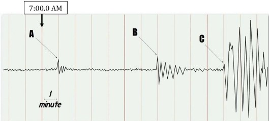 <strong> Using the arrival times in this image, determine the S-minus-P interval for this earthquake.</strong> A)6)0 minutes B)4)1 minutes C)10.1 minutes D)3)7 minutes