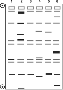 <strong>Figure 10.2 This figure shows the results of a gel electrophoresis separation of restriction fragments of the DNA of different organ In Figure 10.2, which two are most closely related?</strong> A) 3 and 5 B) 2 and 5 C) 4 and 5 D) 2 and 4 E) 1 and 3