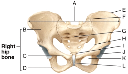 Which of the labeled bone markings in the diagram is the acetabulum?