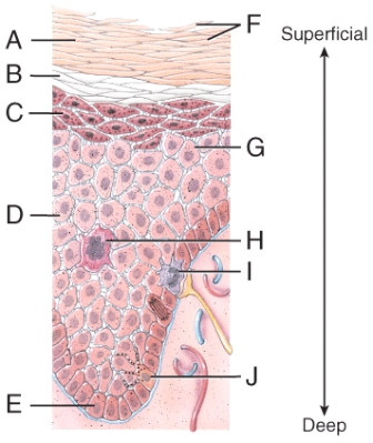 Which of the labeled epidermal cells in the diagram helps the immune system to recognize foreign microbes present in the skin?  