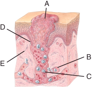 In the given diagram, which label represents the cells that migrate into a deep wound and lay down collagen fibers within the wound to form scar tissue?  