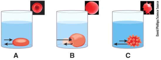 Which diagram and picture in the figure best represents the results obtained when placing red blood cells into a hypertonic solution?