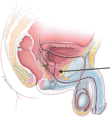 <strong>What is the structure indicated in the figure? </strong> A) urinary bladder B) testis C) bulbourethral gland D) prostate