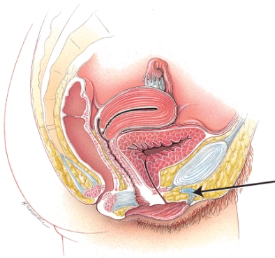 <strong>What structure is indicated in the diagram? </strong> A) ovary B) uterus C) vagina D) clitoris