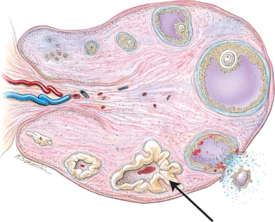 <strong>What structure is indicated? </strong> A) secondary follicle B) corpus luteum C) mature (Graafian) follicle D) corpus albicans