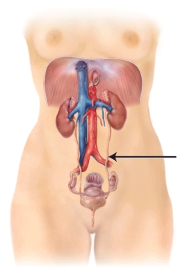 <strong>What is the structure that is indicated on the diagram? </strong> A) right renal artery B) left renal vein C) left ureter D) left urethra
