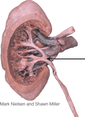 <strong>What is the structure indicated in the diagram? </strong> A) renal pelvis B) minor calyx C) renal vein D) major calyx