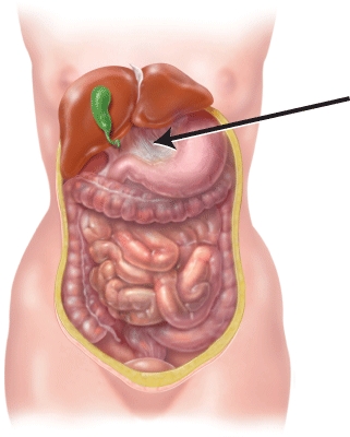 <strong>Identify the structure indicated in the figure.  </strong> A) gallbladder B) sigmoid colon C) greater omentum D) lesser omentum <div style=padding-top: 35px> 