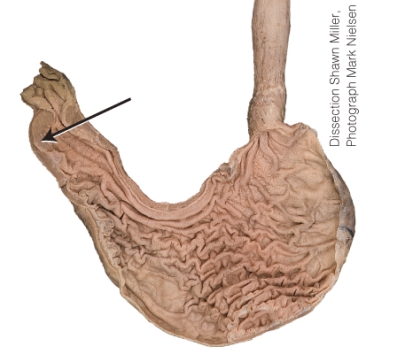<strong>What is the structure the arrow is pointing to?  </strong> A) rugae B) fundus C) cardia D) pyloric sphincter <div style=padding-top: 35px> 