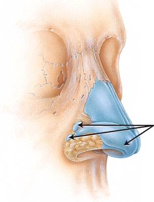 <strong>Which cartilages are indicated in the figure?  </strong> A) nasal B) lateral C) septal D) alar <div style=padding-top: 35px> 