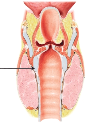 In this lateral view of the larynx, which cartilage is indicated?