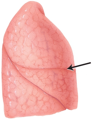 <strong>In this lateral view of the right lung, the arrow is pointing to which structure?  </strong> A) hilum B) cardiac notch C) apex D) horizontal fissure <div style=padding-top: 35px> 
