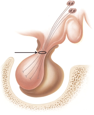 <strong>The arrow is pointing to which structure?  </strong> A) paraventricular nucleus B) supraoptic nucleus C) infundibular venous plexus D) axons of neurosecretory cells <div style=padding-top: 35px> 