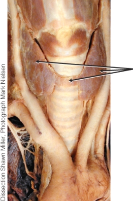 <strong>What is the endocrine gland labeled with the arrow?  </strong> A) pituitary B) thymus C) pancreas D) thyroid <div style=padding-top: 35px> 