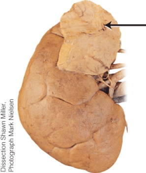 <strong>What is the endocrine gland labeled with the arrow?  </strong> A) adrenal B) pineal C) thymus D) testis <div style=padding-top: 35px> 