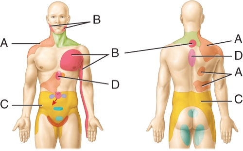 <strong>Referred pain site for the heart  </strong> A) A B) B C) C D) D <div style=padding-top: 35px> 