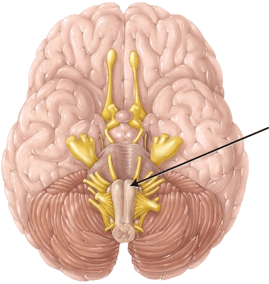 <strong>The structure indicated by the arrow </strong> A) is where the rubrospinal tract begins. B) is where the corticospinal tract decussates. C) is where the spinothalamic tract crosses. D) is where third-order neurons of the posterior (dorsal) column tract originate.