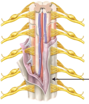 The meninx indicated by the line is the _____.  