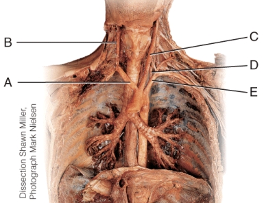 Which of the vessels of the neck are NOT direct branches of the arch of the aorta?
