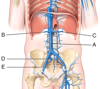 <strong>The left testicular (or ovarian) vein drains into the _____, whereas the right testicular (or ovarian) vein drains into the _____. </strong> A) A; B B) B; C C) D; E D) C; A