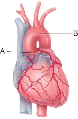 <strong>Match the vessel with the description. Pulmonary trunk:  </strong> A) carries deoxygenated blood away from the heart B) carries deoxygenated blood toward the heart <div style=padding-top: 35px> 