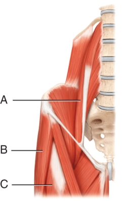 <strong>The muscle indicated by line A is the  </strong> A) Psoas major B) Gracilis C) Obturator externus D) Iliacus <div style=padding-top: 35px> 