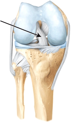 The line is pointing to the _____ ligament.  <div style=padding-top: 35px> 