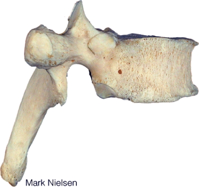 <strong>What type of vertebra is shown in here? </strong> A) cervical B) thoracic C) lumbar D) sacral