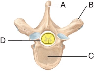 <strong>The label on the spinous process is _____. </strong> A) A B) B C) C D) D