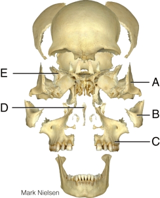 <strong>Where is the zygomatic bone? </strong> A) A B) B C) C D) D E) E
