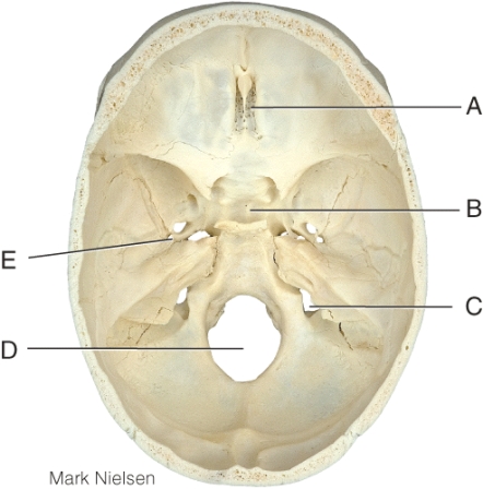 <strong>Where is the pituitary gland located? </strong> A) A B) B C) C D) D E) E