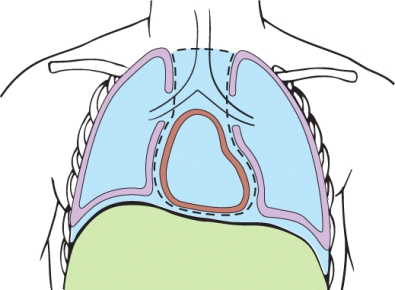 What type of section was performed on this torso?