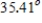 <strong>Find the angle θ between the vectors. (Round the answer to 2 decimal places.) </strong> A) B) C) D) E)