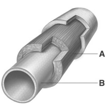 <strong> If the figure shown is an elastic artery,the layer letter B is pointing to is composed of</strong> A)smooth muscle only. B)smooth muscle and elastic tissue. C)endothelium only. D)endothelium and basement membrane. E)elastic tissue only.