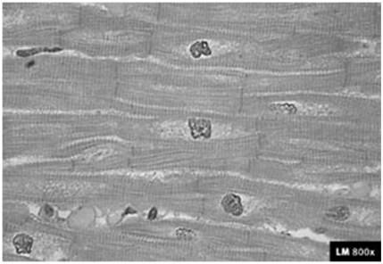 <strong> The type of muscle shown in the diagram is</strong> A)cardiac B)smooth C)skeletal