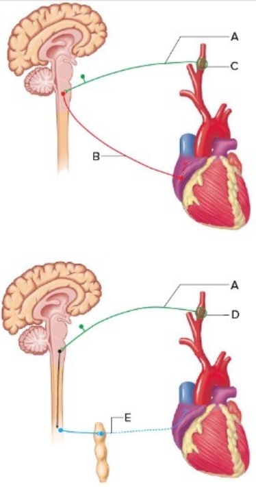 <strong>  The figure illustrates the autonomic reflexes and the heart. What does A represent?</strong> A) Sympathetic nerve B) Increase in blood pressure detected by carotid baroreceptors C) Glossopharyngeal nerve D) Decrease in blood pressure detected by carotid baroreceptors E) Vagus nerve <div style=padding-top: 35px> 