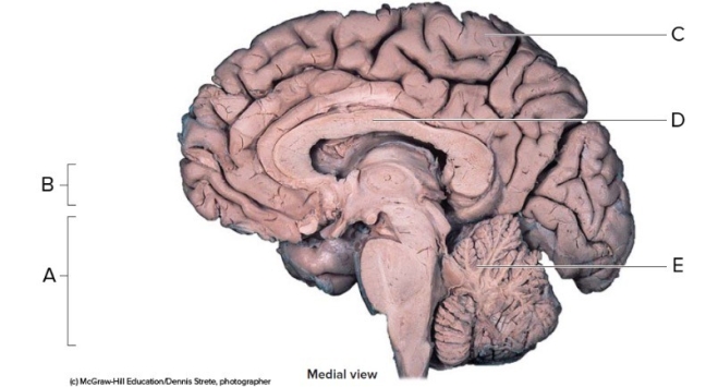 -This is a midsagittal section of the right half of the brain. What does A represent?