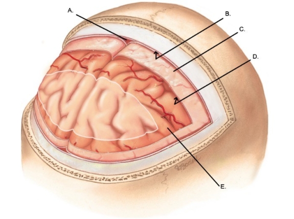 -What does E represent on the diagram of the skull and brain?