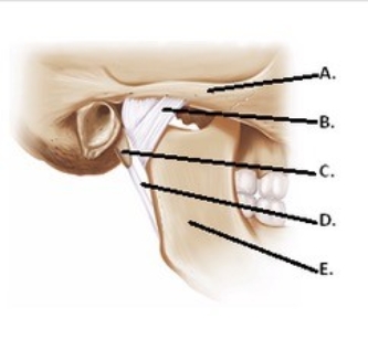 -The figure illustrates structures in the right temporomandibular joint (lateral view). What does A represent?