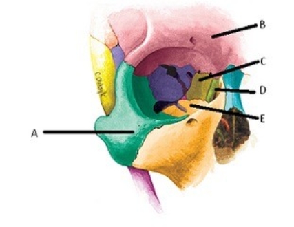 -The figure shows the bones of the right orbit. What bone does D represent?