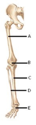-The figure illustrates bones of the right lower limb. What does E represent?
